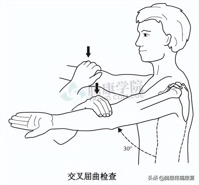 biceph，肩关节的特殊检查（bicep curl）