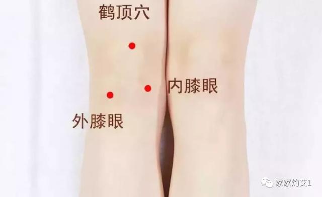 膝盖积液艾灸哪个部位，膝盖积液如何艾灸（隔姜灸治疗膝关节积液）