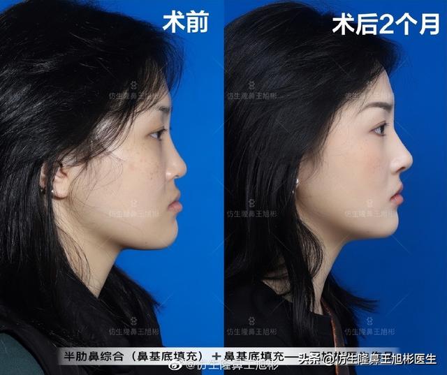 高级脸是什么意思，6种脸型不显老（“月亮脸”逆袭“高级脸”的不二法则是）