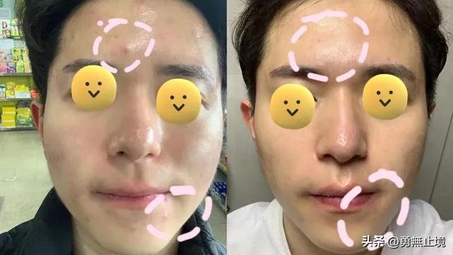 男士用什么面膜好,男生用什么面膜好(2022男士面膜专业测评) 男士用什么面膜好,男生用什么面膜好(2022男士面膜专业测评)