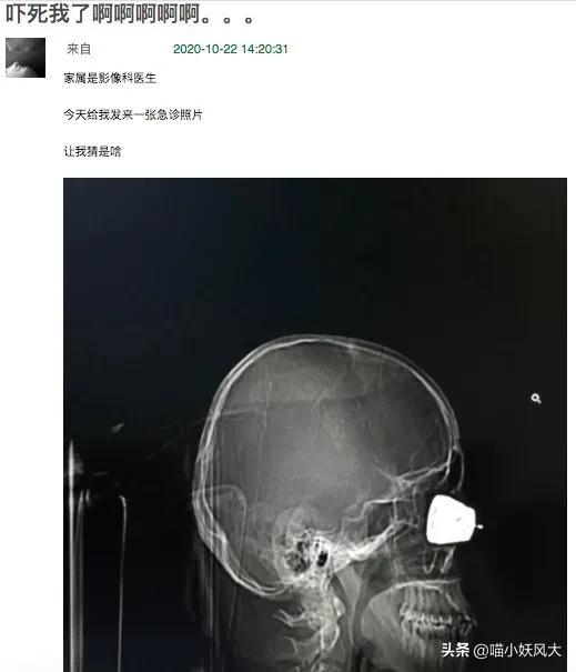 高压锅会不会爆炸，那些做法可能造成高压锅爆炸（高压锅爆炸威力有多大、要怎么防）