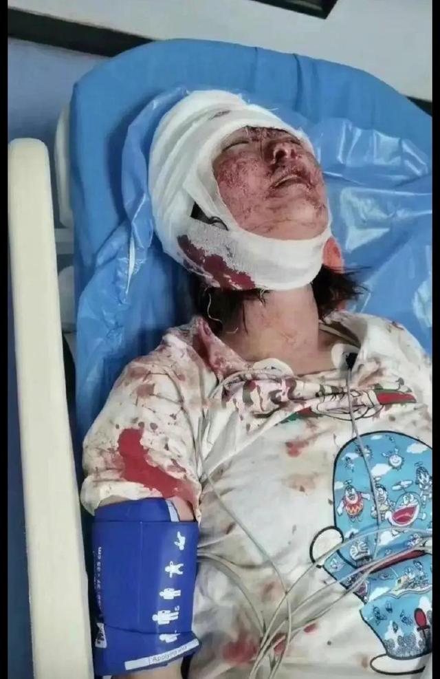 2,唐山烧烤店多名男子围殴两女子致其重伤,打人者最高可判刑多久?