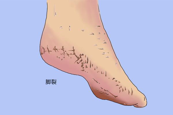 十大促进伤口愈合的食物，刀口有个洞一直不愈合（伤口消毒应该用什么）