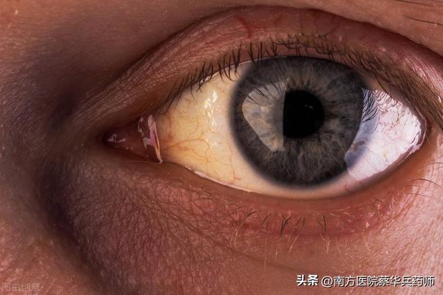 过路黄的功效与作用，过路黄的功效与作用！（用于排石汤；清热利湿能退黄）