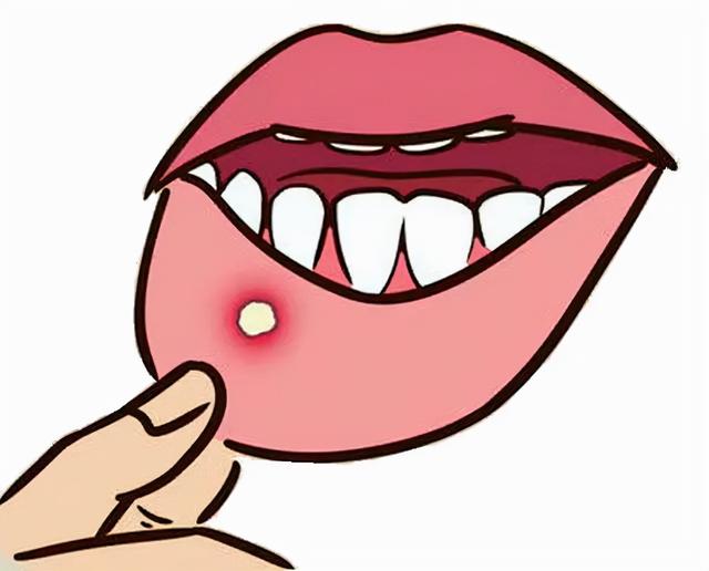 打胎药网上哪里有卖的，打胎药网上哪里有卖的吗（歪打正着的药物<三>）