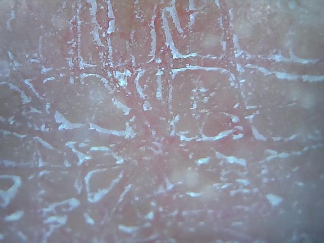 脸部能天天热敷吗，热敷脸有哪些功效与作用（面膜可以天天敷吗）