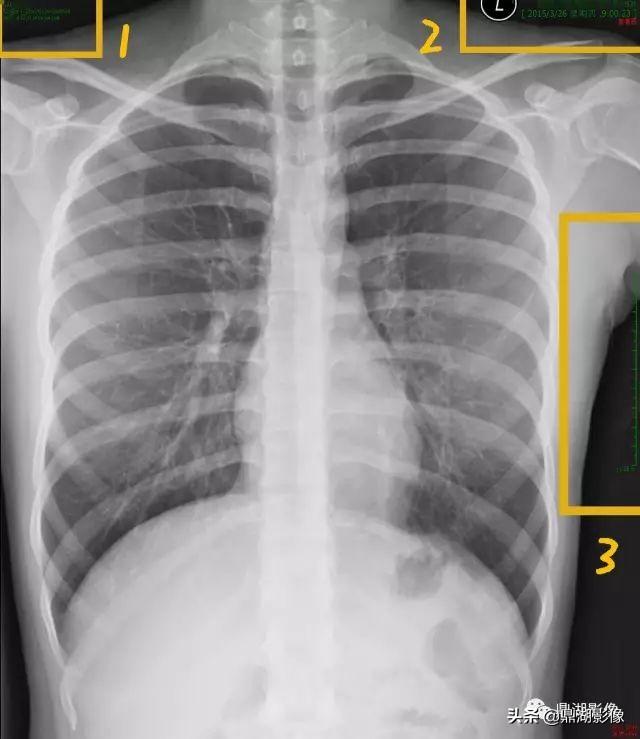 r和l哪个是左哪个是右，袜子r和l哪个是左哪个是右（竟然包含了这么多的信息）