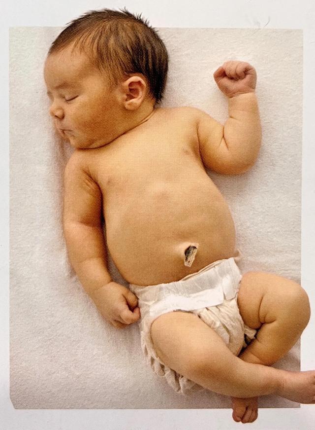 出生一个星期的婴儿奶量是多少，1-30天新生儿奶量标准（新生宝宝的体重为何不升反降）