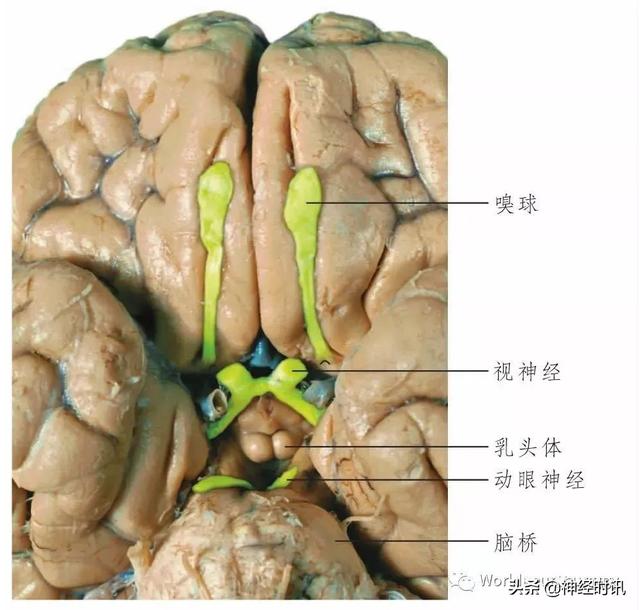 属于膜迷路的结构是，属于膜迷路的结构是蜗管蜗顶（彩图经典版│脑神经和脑神经核解剖）