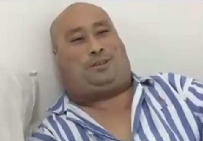 粗脖子背后的秘密