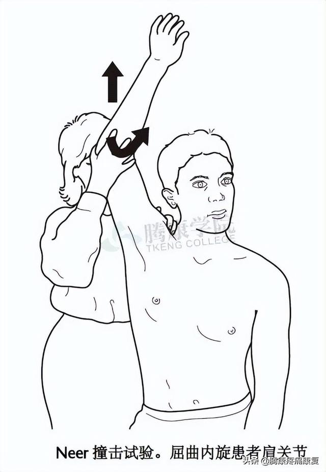 biceph，肩关节的特殊检查（bicep curl）