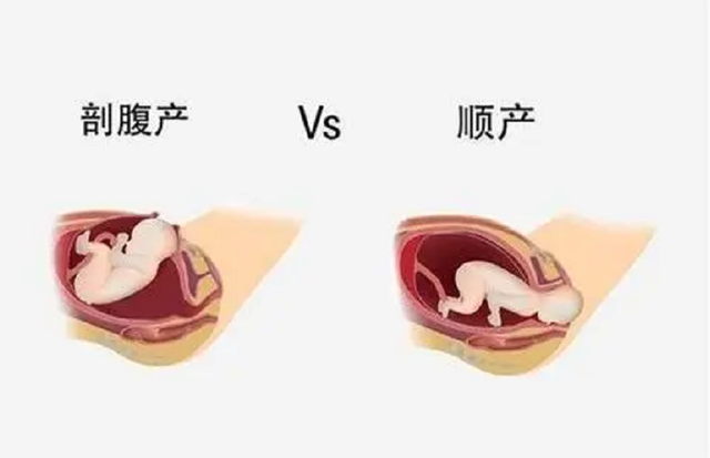 滞留针是什么 滞留针的解释，滞留针是什么（32年后当事人：赔我100万）