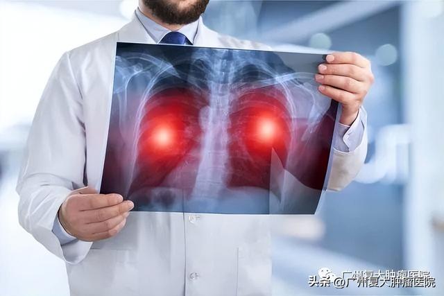 病毒性肺炎症状有哪些，老年人病毒性肺炎症状有哪些（常见病毒性肺炎的影像学特征）