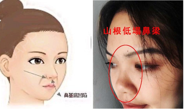 山根低和鼻梁低的区别图片，山根低和鼻梁低的区别 面相（知道这3个变美思路）