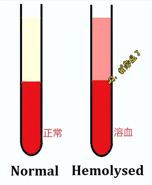 仅供参考什么意思，梦见和前任接吻是什么意思（为什么有的化验单上注明“结果仅供参考”）