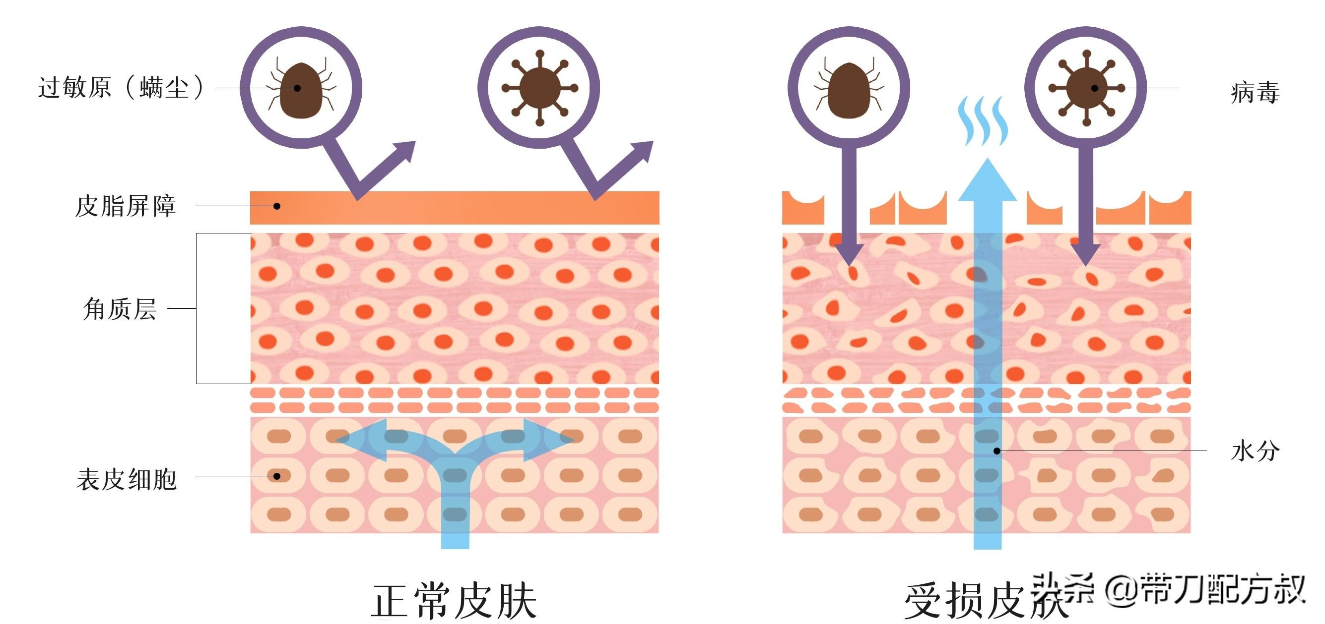 红血丝用什么化妆品修复最好，红血丝适合用的护肤品