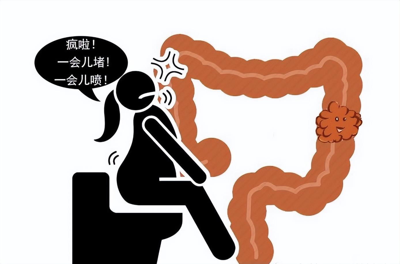 少女腹痛疑似肠梗阻,灌肠后解出8斤大便,医生:是先天性巨结肠-质信十