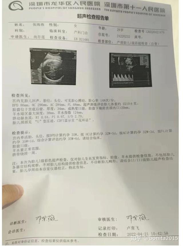 怀孕全过程是怎样的，怀孕的全程过程（2021年-2022年广州产检深圳生娃全流程）