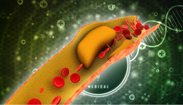 橄榄油的作用与功效，芦荟胶加橄榄油的作用与功效（专家新研究：每天半勺）