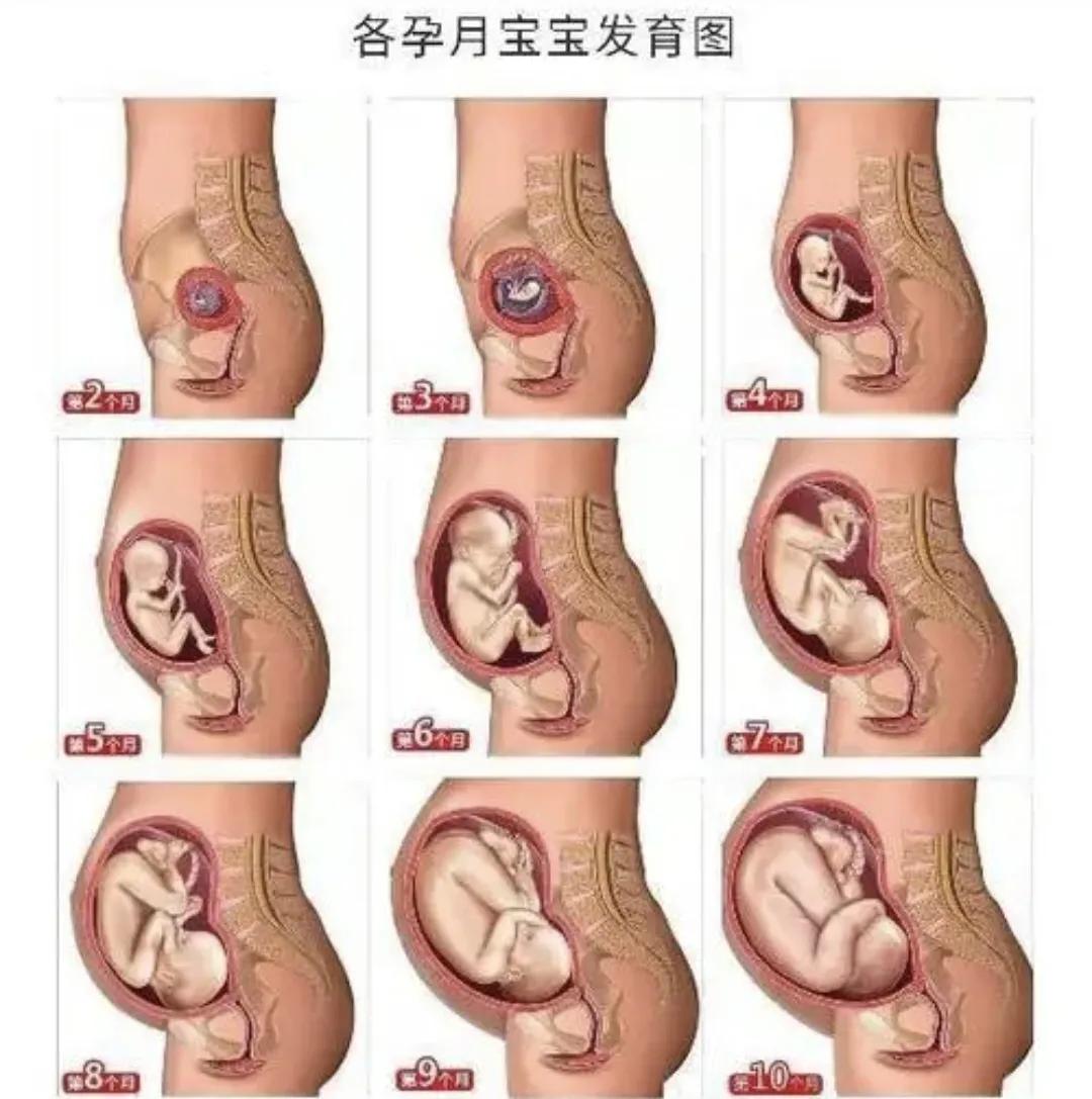 孕妇检查开指图片图片
