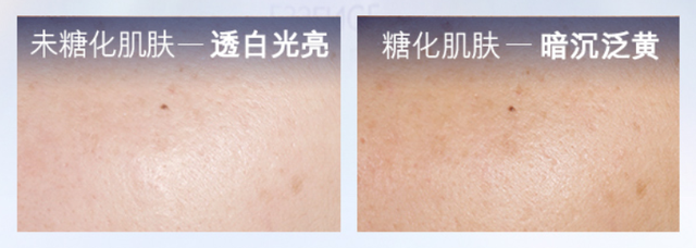 如何养成冷白皮肤，如何养成冷白皮（别再乱用美白产品了）