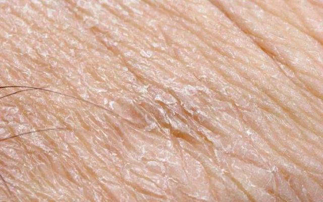 脸部能天天热敷吗，热敷脸有哪些功效与作用（面膜可以天天敷吗）