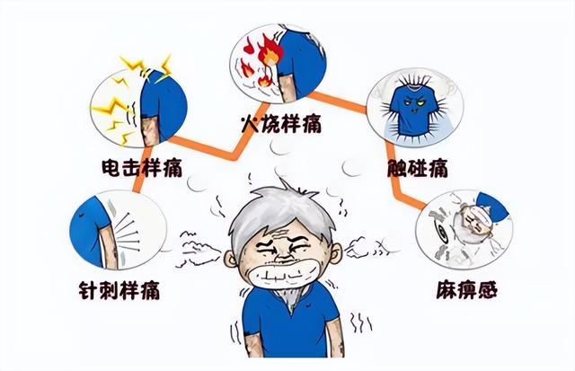 左边头部一阵一阵痛怎么办(可能是你的三叉神经犯了错)