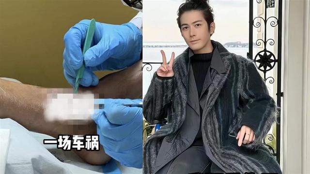 陈学冬怎么销声匿迹了，首度透露消失是因为出严重车祸