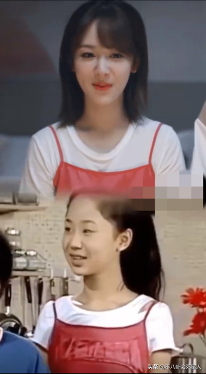 整容后遗症有哪些，整容后遗症有哪一些（明星整容后遗症明显）