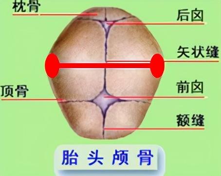 生孩子是突然发动还是有预兆，分娩发动是突然的吗（胎位为什么头先出来是正常）