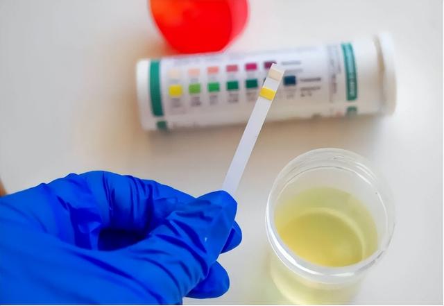 嘌呤高是什么意思，高嘌呤是什么意思（“嘌呤大户”被揪出）