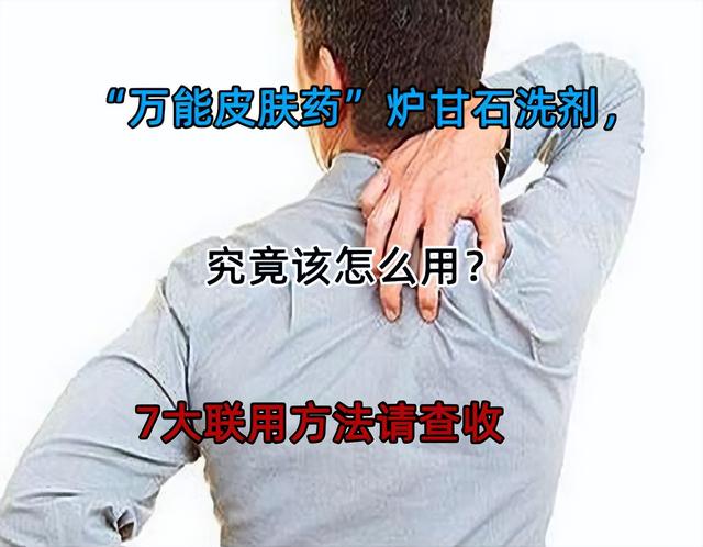 玫瑰糠疹吃什么药，玫瑰糠疹吃什么药好使（“万能皮肤药”炉甘石洗剂）