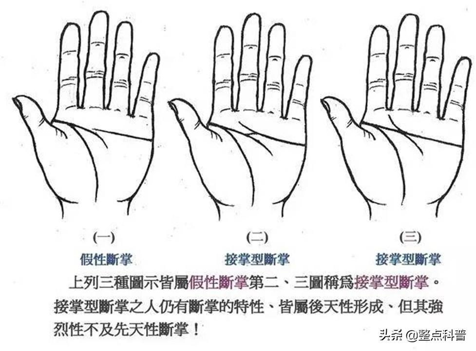 相學中雙手斷掌有何說法,男兒斷掌千斤兩 相學中雙手斷掌有何說法,男兒斷掌千斤兩