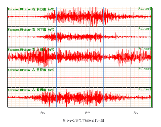 练背的健身动作，如何练好健身动作之背部肌肉详细动作（8个经典背部训练动作）