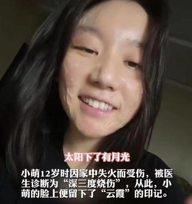 隆胸手术的真正人体过程，女主播大胆直播丰胸手术全过程