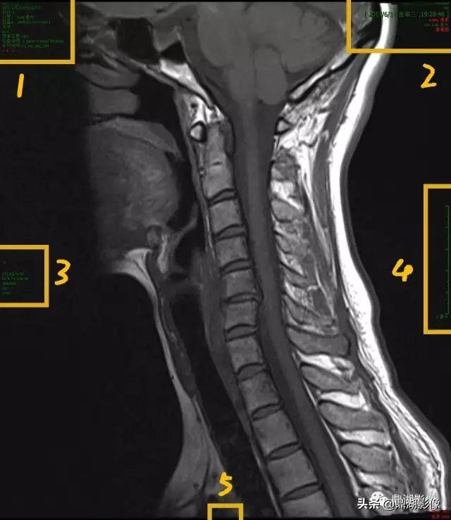 r和l哪个是左哪个是右，袜子r和l哪个是左哪个是右（竟然包含了这么多的信息）