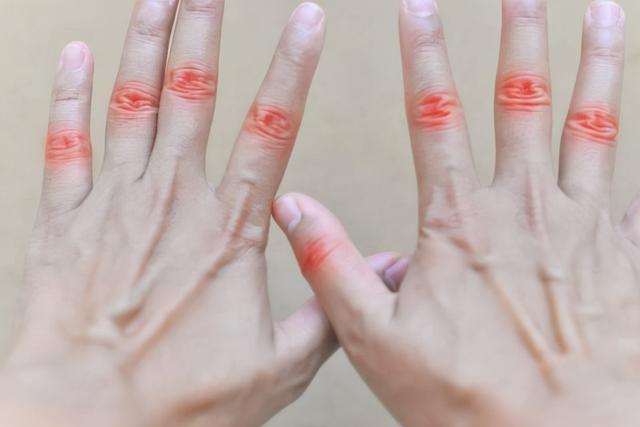 手指关节疼痛怎么办，女性更年期手指关节疼痛怎么办（学会这2个动作，缓解不适感）