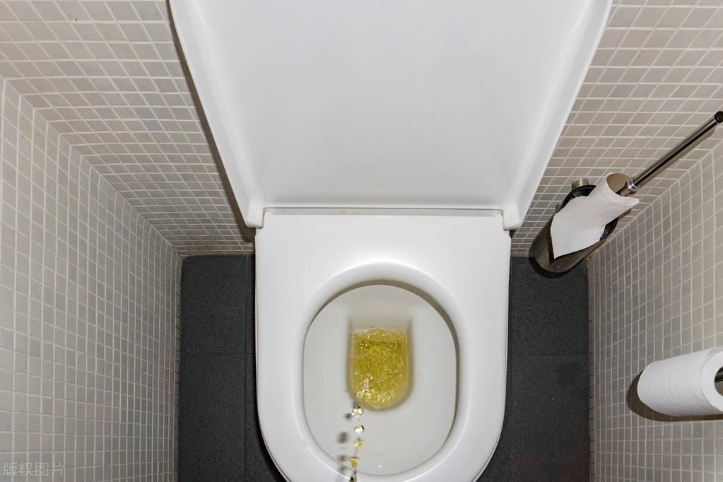 晨尿有哪些变化,说明疾病来袭?