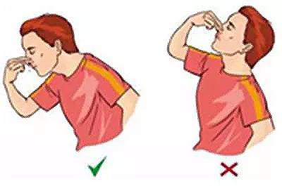 小孩经常流鼻血需要做哪些检查，了解这些原因以及处理方法