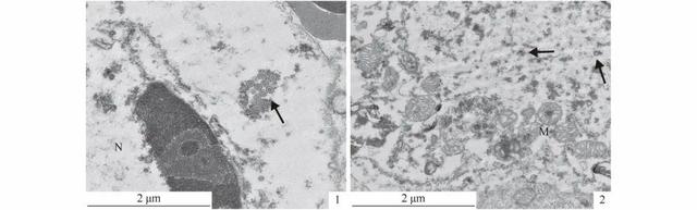 dpbs和pbs的区别，pbs缓冲液配制（四川地区养殖鲫鲤疱疹病毒Ⅱ型的鉴定及病理学研究）