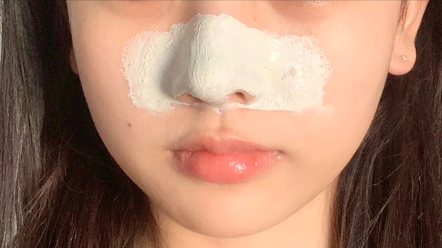 学生如何自己去黑头，想要短期内改善黑头情况