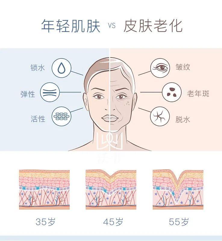 怎么减少眼部皱纹，5个去眼部细纹最有效的方法