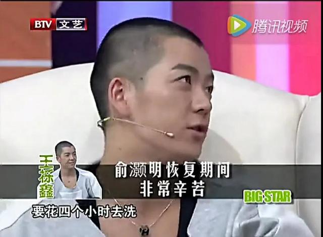 演员俞灏明：19岁出道，23岁被大火毁容，如今35岁的他涅槃重生