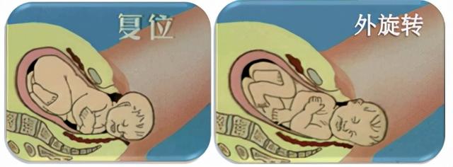 生孩子是突然发动还是有预兆，分娩发动是突然的吗（胎位为什么头先出来是正常）
