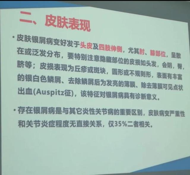 狗皮癣怎么治疗，宠物身上的癣怎样治好（为啥会得牛皮廯）