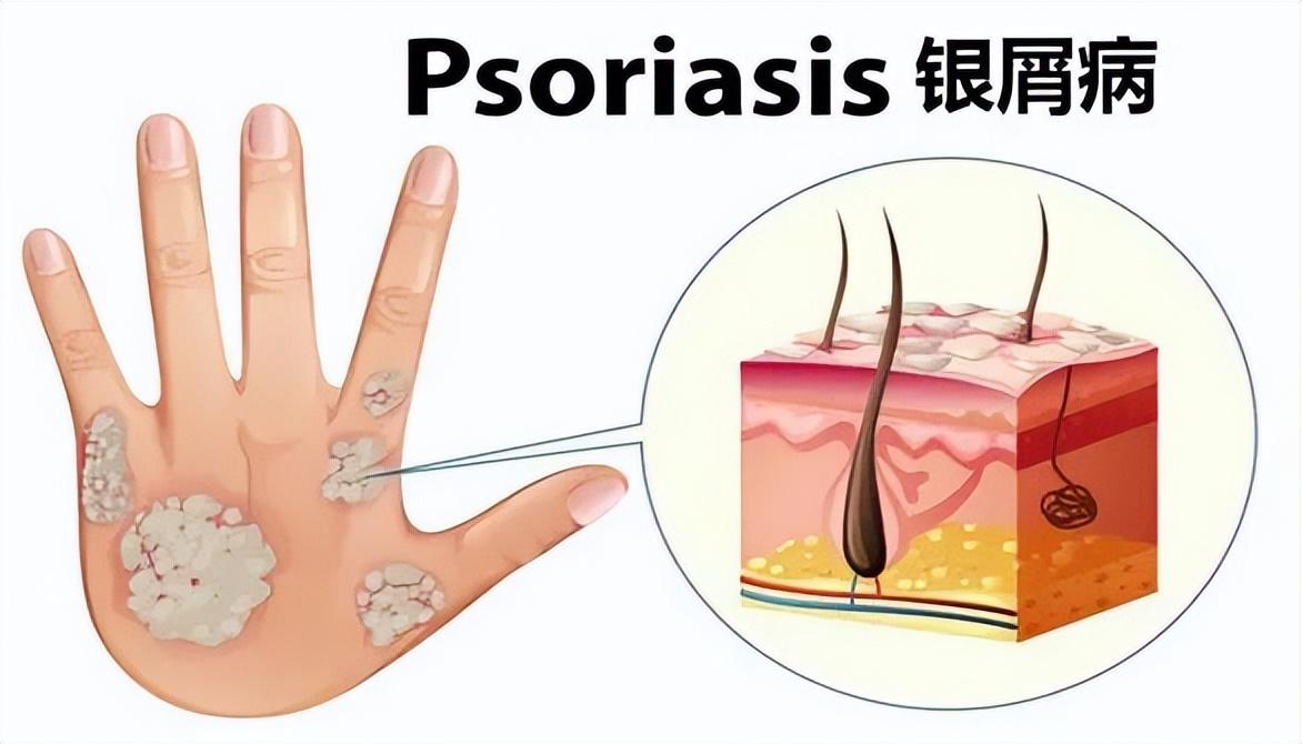 姜黄素是什么东西，含姜黄素食物十大排名（皮肤抗炎杀菌的一把好手）