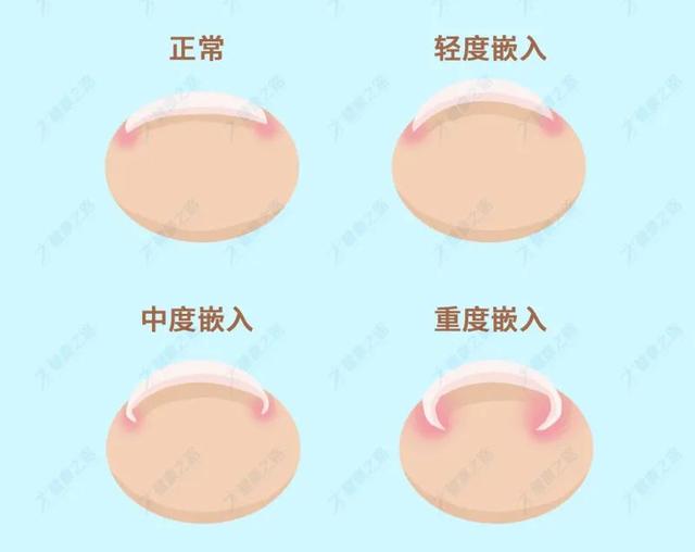 如何使用指甲剪修剪指甲，指甲应该怎么修剪（你可能都用错了方法）