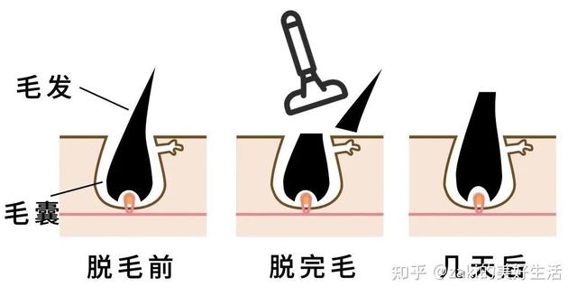 薇婷脱毛膏正确使用方法，薇婷脱毛膏正确使用方法图解（5款爆火脱毛产品真人实测）