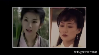 鼻翼肥大怎么办，鼻翼肥大怎么改善（如何改善鼻头圆和鼻翼宽）