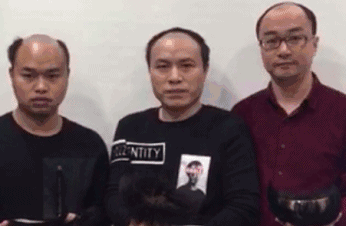 女生长胡子的原因，女生体毛多、长胡子、私处的毛又粗又长